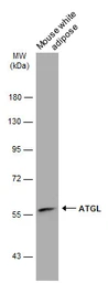 Anti-ATGL antibody [N1C1] used in Western Blot (WB). GTX109941
